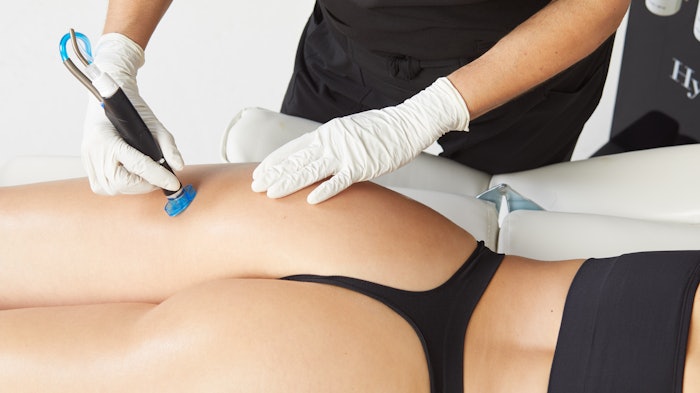 Treat Body Breakouts & Loose Skin with Hydrafacial's Hydrabooty Treatment