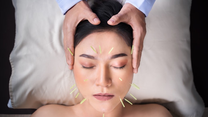 Insider Insight into the Ancient Powers of Acupuncture